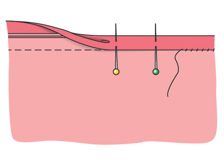 Косая бейка: полоска ткани с многофункциональным назначением